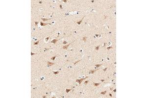 Immunohistochemical analysis of paraffin-embedded human brain tissue using (ABIN655975 and ABIN2845360) performed on the Leica® BOND RXm. (AP1M1 anticorps  (AA 199-227))