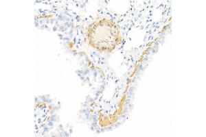 Immunohistochemistry of paraffin-embedded mouse kidney using Caspase-7 Rabbit pAb (ABIN3022071, ABIN3022072, ABIN3022073 and ABIN6218596) at dilution of 1:150 (40x lens).