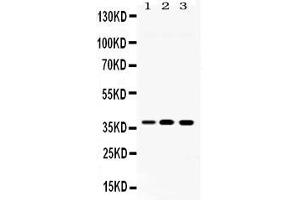 Western blot analysis of LDHA expression in rat spleen extract ( Lane 1), ANA-1 whole cell lysates ( Lane 2) and JURKAT whole cell lysates ( Lane 3).