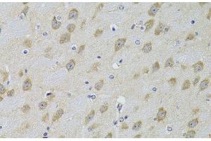 Immunohistochemistry of paraffin-embedded Mouse brain using ADRBK2 Polyclonal Antibody at dilution of 1:100 (40x lens). (ADRBK2 anticorps)