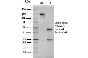 SDS-PAGE Analysis Purified PAI-RBP1 Mouse Monoclonal Antibody (SERBP1/3496).