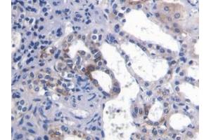 Detection of PECAM1 in Mouse Kidney Tissue using Polyclonal Antibody to Platelet/Endothelial Cell Adhesion Molecule (PECAM1)
