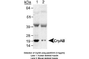 Image no. 1 for anti-Crystallin, alpha B (CRYAB) (AA 100-175), (Internal Region) antibody (ABIN363532) (CRYAB anticorps  (Internal Region))