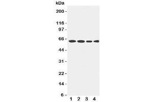 Western blot testing of LCAT antibody and Lane 1:  rat brain;  2: U87;  3: HeLa;  4: SMMC-7721 cell lysate. (LCAT anticorps  (AA 300-313))