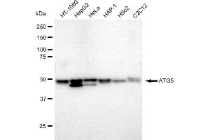 Western blotting analysis using ATG5 antibody (ABIN7797674).
