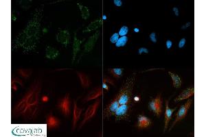 Image no. 5 for anti-Beclin 1, Autophagy Related (BECN1) antibody (ABIN363435) (Beclin 1 anticorps)