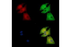 ABIN7095188 and ABIN7099244 staining  cells by IF/ICC. (CLIC5 anticorps)