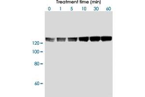 Phosphorylation of recombinant MBS on threonine-853 residue by recombinant Rho-kinase 2 in vitro. (PPP1R12A anticorps  (pThr853))