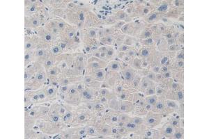 IHC-P analysis of Kidney tissue, with DAB staining. (GRK4 anticorps  (AA 187-449))