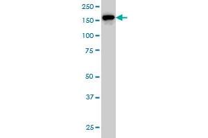 ROCK2 monoclonal antibody (M01), clone 2A4 Western Blot analysis of ROCK2 expression in HeLa . (ROCK2 anticorps  (AA 1279-1388))