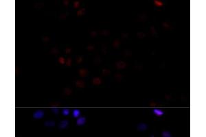Immunofluorescence analysis of HeLa cells using TBP Polyclonal Antibody at dilution of 1:100 (40x lens). (TBP anticorps)