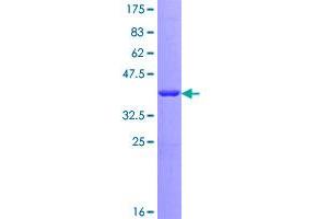 Image no. 1 for Replication Protein A3, 14kDa (RPA3) (AA 1-121) protein (GST tag) (ABIN1318504)