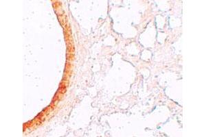 Immunohistochemical staining of mouse lung cells with SLC39A3 polyclonal antibody  at 5 ug/mL. (SLC39A3 anticorps  (Internal Region))