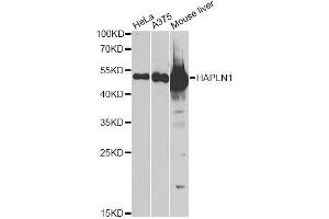 Western blot analysis of extracts of various cell lines, using HAPLN1 antibody.