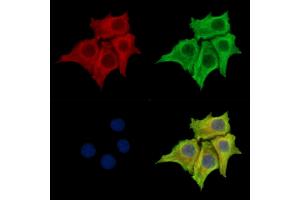 ABIN7095170 and ABIN7099226 staining Hela cells by IF/ICC.
