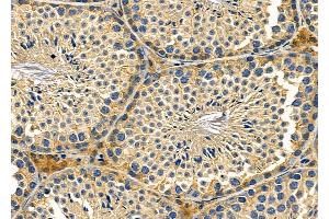 ABIN6259699 and ABIN6279056 at 1/100 staining Mouse testis tissue by IHC-P. (ABHD13 anticorps  (Internal Region))