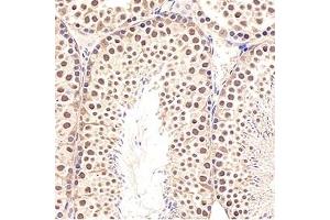 Immunohistochemistry analysis of paraffin-embedded mouse testis using,GTF2F2 (ABIN7074036)at dilution of 1: 3000 (GTF2F2 anticorps)