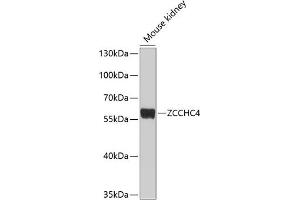 Western blot analysis of extracts of mouse kidney, using ZCCHC4 antibody (ABIN6133077, ABIN6150408, ABIN6150409 and ABIN6214292) at 1:1000 dilution. (ZCCHC4 anticorps  (AA 50-220))