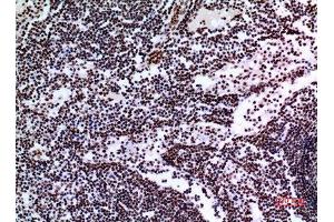 Immunohistochemistry (IHC) analysis of paraffin-embedded Human Lymph Gland, antibody was diluted at 1:100.