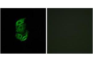 Immunofluorescence analysis of A549 cells, using STA13 Antibody. (STARD13 anticorps  (AA 101-150))