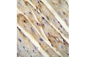 Immunohistochemistry analysis in formalin fixed and paraffin embedded mouse heart tissue reacted with GAS1 Antibody (N-term) followed which was peroxidase conjugated to the secondary antibody and followed by DAB staining.