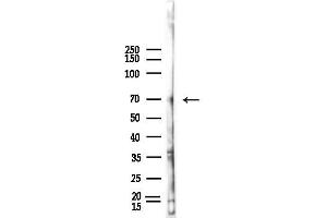 anti-TSPY-Like 2 (TSPYL2) (Internal Region) antibody