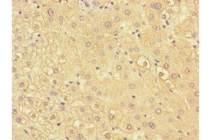 Immunohistochemistry of paraffin-embedded human liver tissue using ABIN7157503 at dilution of 1:100 (KIR2DL3 anticorps  (AA 22-245))