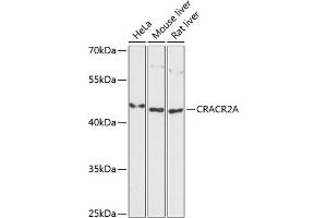 Western blot analysis of extracts of various cell lines, using CRA antibody (ABIN6132088, ABIN6139000, ABIN6139002 and ABIN6217974) at 1:3000 dilution. (EFCAB4B anticorps  (AA 1-200))