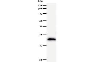Western Blotting (WB) image for anti-Nucleoporin 93kDa (NUP93) antibody (ABIN931082) (NUP93 anticorps)