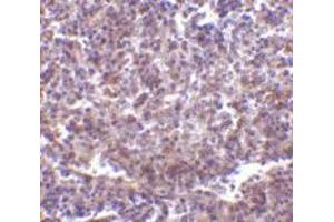 Immunohistochemistry of CD180 in human spleen tissue with CD180 polyclonal antibody  at 2 ug/mL . (CD180 anticorps  (N-Term))