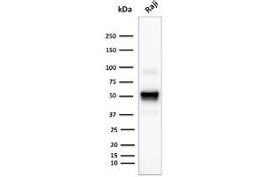 Western Blot Analysis of human Rajj cell lysate using CD79a Monoclonal Antibody (SPM549). (CD79a anticorps  (AA 202-216))