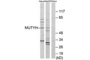 Western Blotting (WB) image for anti-MutY Homolog (E. Coli) (MUTYH) (AA 151-200) antibody (ABIN2890016) (MUTYH anticorps  (AA 151-200))