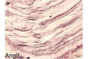 IHC in human nerve tissue.