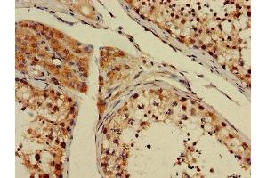 Immunohistochemistry of paraffin-embedded human testis tissue using ABIN7154122 at dilution of 1:100 (GSTT1 anticorps  (AA 2-240))