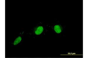 Immunofluorescence of monoclonal antibody to CALCOCO2 on HeLa cell.