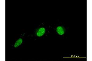 Immunofluorescence of monoclonal antibody to CALCOCO2 on HeLa cell. (CALCOCO2 anticorps  (AA 347-446))