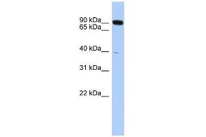 WB Suggested Anti-CXXC1 Antibody Titration:  0. (CXXC1 anticorps  (Middle Region))