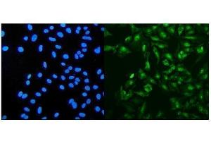 IF analysis of PRDM5 using anti-PRDM5 antibody (ABIN7600853). (PRDM5 anticorps  (AA 24-630))