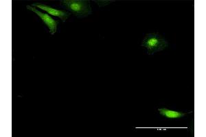 Immunofluorescence of purified MaxPab antibody to NUDC on HeLa cell.