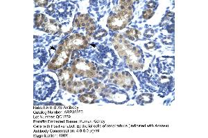 Human kidney (SIX Homeobox 6 anticorps  (N-Term))