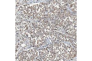 IHC analysis of SFXN3 using anti-SFXN3 antibody (ABIN7601302). (SFXN3 anticorps  (AA 32-321))