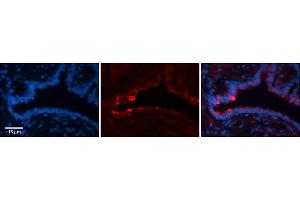 Rabbit Anti-NETO2 Antibody     Formalin Fixed Paraffin Embedded Tissue: Human Bronchial Epithelial Tissue  Observed Staining: Cytoplasmic  Primary Antibody Concentration: 1:100  Secondary Antibody: Donkey anti-Rabbit-Cy3  Secondary Antibody Concentration: 1:200  Magnification: 20X  Exposure Time: 0.