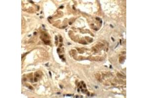 Immunohistochemical staining of human kidney cells with ATAD3B polyclonal antibody  at 5 ug/mL.