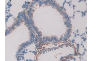 Detection of FBN1 in Rat Lung Tissue using Polyclonal Antibody to Fibrillin 1 (FBN1)