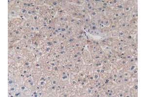 Figure. (JAK1 anticorps  (AA 596-841))