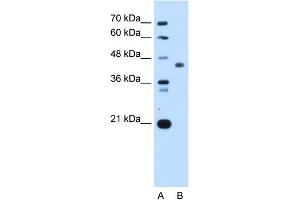 WB Suggested Anti-ST3GAL4 Antibody Titration:  0. (ST3GAL4 anticorps  (Middle Region))