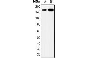 Western blot analysis of YEATS2 expression in MCF7 (A), HeLa (B) whole cell lysates. (YEATS2 anticorps  (Center))