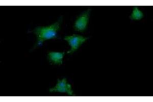 Image no. 7 for anti-DEAD (Asp-Glu-Ala-Asp) Box Polypeptide 58 (DDX58) antibody (ABIN1500708) (DDX58 anticorps)