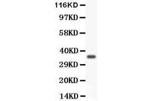 Anti- FOXM1 antibody, Western blotting All lanes: Anti FOXM1  at 0.