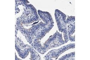 Immunohistochemical staining of human fallopian tube with CROCC polyclonal antibody  shows moderate membranous positivity in ciliated cells at 1:2500-1:5000 dilution.